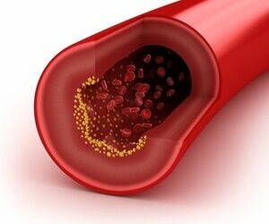 AMA study finds new benefits of cholesterol reducers