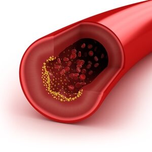 AMA study finds new benefits of cholesterol reducers